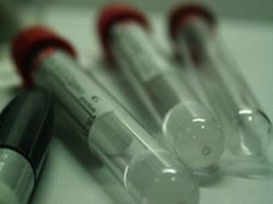 Identifican homínido prehistórico llamado "Mujer X"