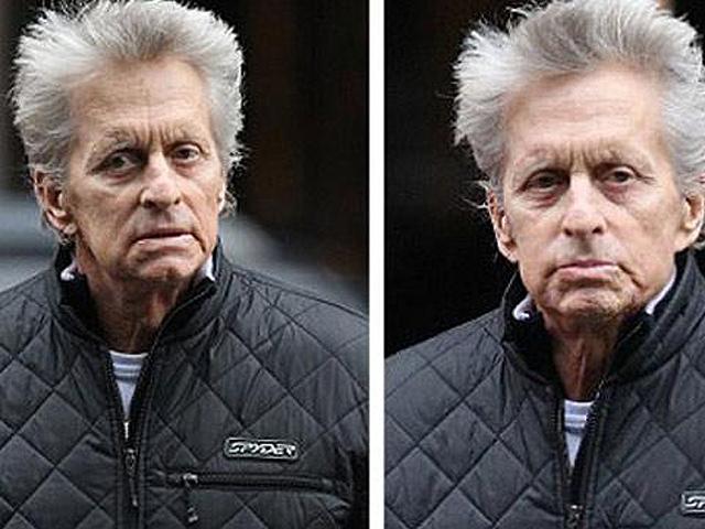 Probabiliades de vida de Michael Douglas son escasas