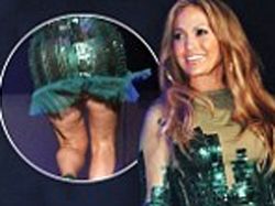 La celulitis de Jennifer Lopez