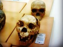 El cerebro humano perdió tamaño, ganó inteligencia