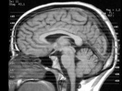 Proceso evolutivo suprimió espinas del pene del hombre