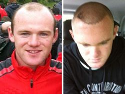 Wayne Rooney lucha para no quedar calvo y se hizo injerto Wayne Rooney lucha para no quedar calvo y se hizo injerto