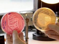 Gobierno de Perú toma medidas para prevenir la E.coli