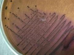 Disminuyeron los coliformes fecales en costas de capital