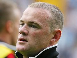Wayne Rooney quedó platinado luego de trasplante de pelo Wayne Rooney quedó platinado luego de trasplante de pelo