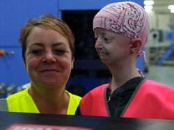 El conmovedor caso de una niña con cuerpo de anciana