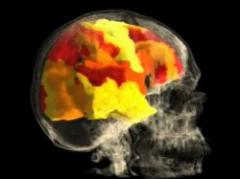 Orgasmo femenino: imágenes desde el interior