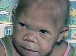 Tiene 30 años pero el cuerpo y comportamiento de un bebé Tiene 30 años pero el cuerpo y comportamiento de un bebé