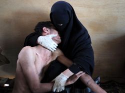 Foto de las revueltas en Yemen ganó el World Press Photo