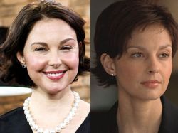 Ashley Judd, otra víctima de malogradas cirugías estéticas