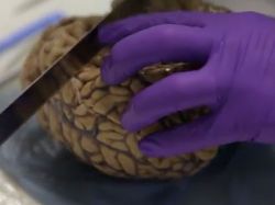 Exponen en Londres cerebros de Einstein y otros genios