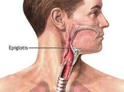 Epiglotitis: primer caso en 20 años alerta a especialistas