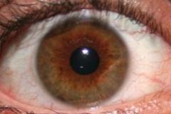 Científicos esperan tratar la ceguera mediante inyección