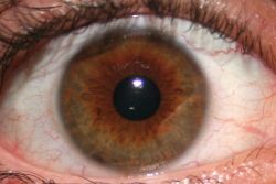 Científicos esperan tratar la ceguera mediante inyección