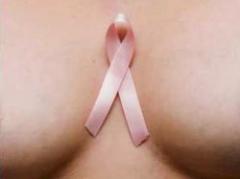 Descubren proteína que hace más agresivo cáncer de mama