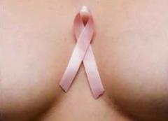 Cáncer de mama: lanzan nueva medicación preventiva