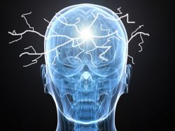 Hallan elemento clave para prevenir la epilepsia