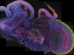 Desarrollan pequeños cerebros a partir de células madre