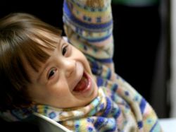 Descubren compuesto que podría curar síndrome de Down