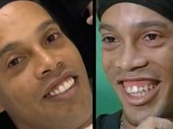 Ronaldinho presentó su nueva dentadura de 50.000 euros Ronaldinho presentó su nueva dentadura de 50.000 euros