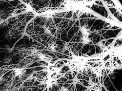 Cambios en funcionamiento de neuronas provocan obesidad