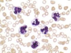 Científicos usan células madre para apurar cicatrización