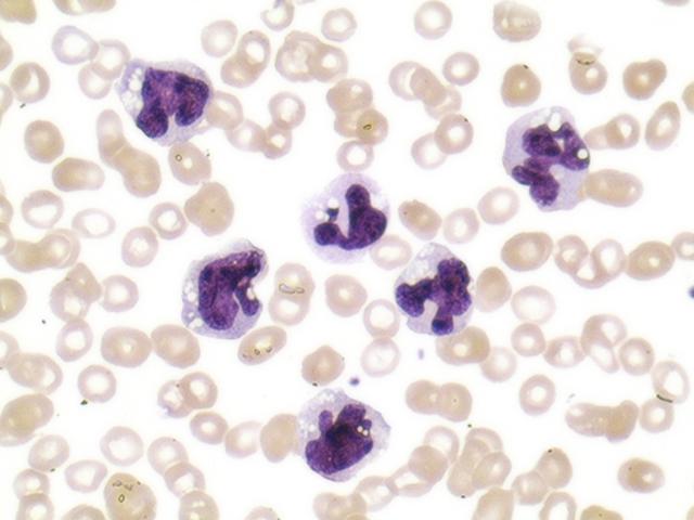 Científicos usan células madre para apurar cicatrización