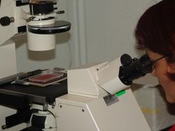 Inhibición de una proteína puede mejorar aterosclerosis