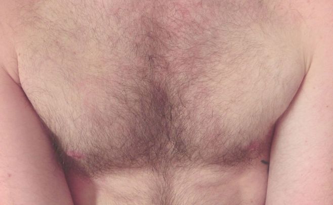 Hombres con pecho peludo serían más inteligentes Hombres con pecho peludo serían más inteligentes