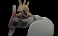 Francia: Trasplantan un corazón artificial con tejidos biológicos