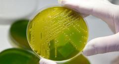 Superbacterias multirresistentes: una bomba de tiempo