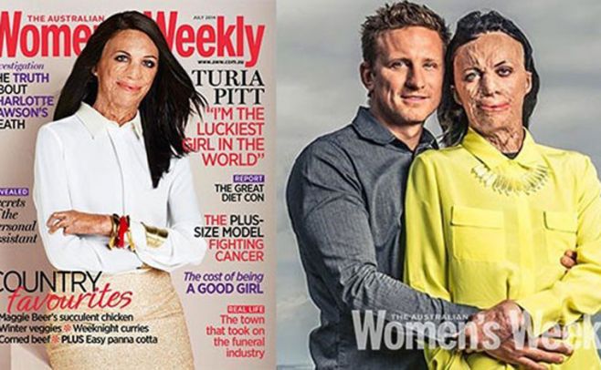 Turia Pitt junto a su novio Michael Hoskin