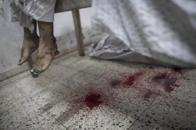 Los pies de un ni�o herido en  el hospital Al Shifa, en Gaza.. EFE