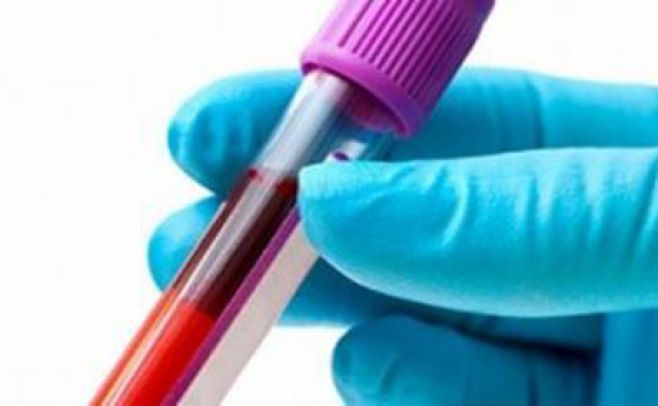 Fármaco contra melanoma crea esperanzas en expertos