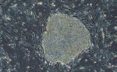 Método para tratar distrofia muscular con células iPS