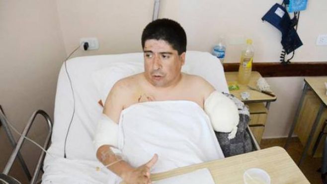 Compró un perro por los robos, pero lo atacó y perdió el brazo