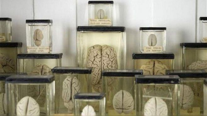 Desaparecen 100 cerebros del sótano de Universidad de Texas