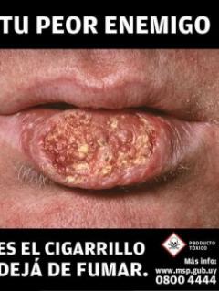 MSP presentó nuevos pictogramas que estarán en cajas de cigarrillos