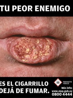 MSP presentó nuevos pictogramas que estarán en cajas de cigarrillos. EFE