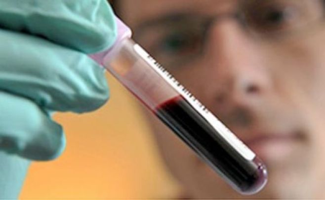 Análisis de sangre descubre virus que afectan a una persona