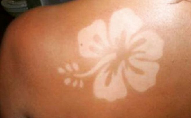 "Sunburn Art", la peligrosa moda de tatuarse con el sol. Redes sociales