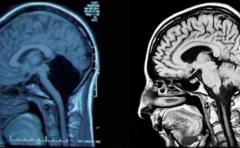 ¿Cómo opera el cerebro ante situaciones de riesgo?