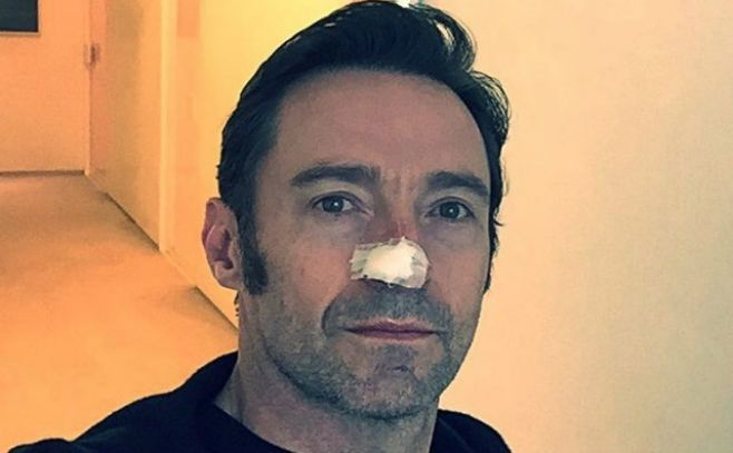 Hugh Jackman fue operado por sexta vez de cáncer de piel